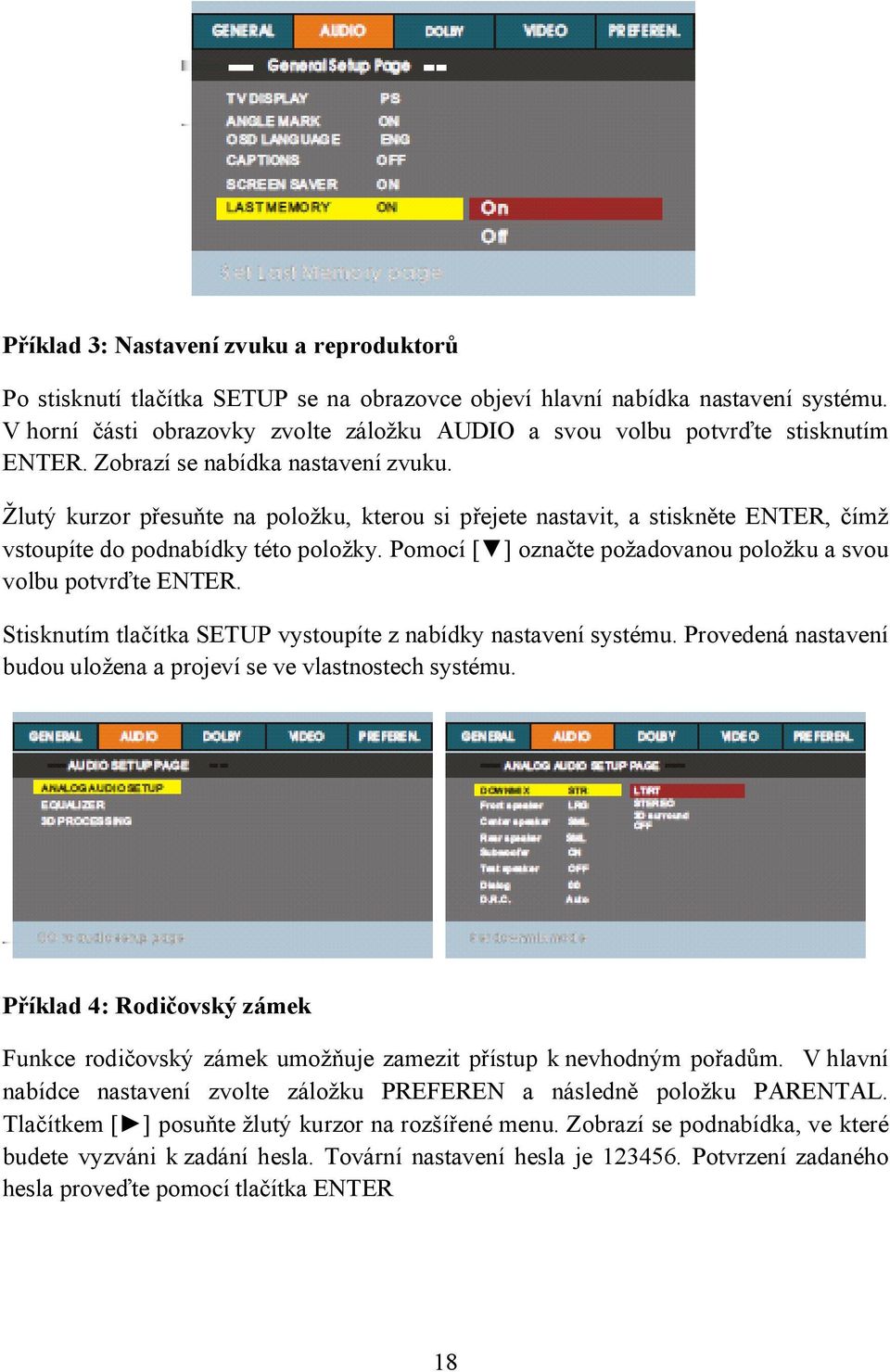 Žlutý kurzor přesuňte na položku, kterou si přejete nastavit, a stiskněte ENTER, čímž vstoupíte do podnabídky této položky. Pomocí [ ] označte požadovanou položku a svou volbu potvrďte ENTER.