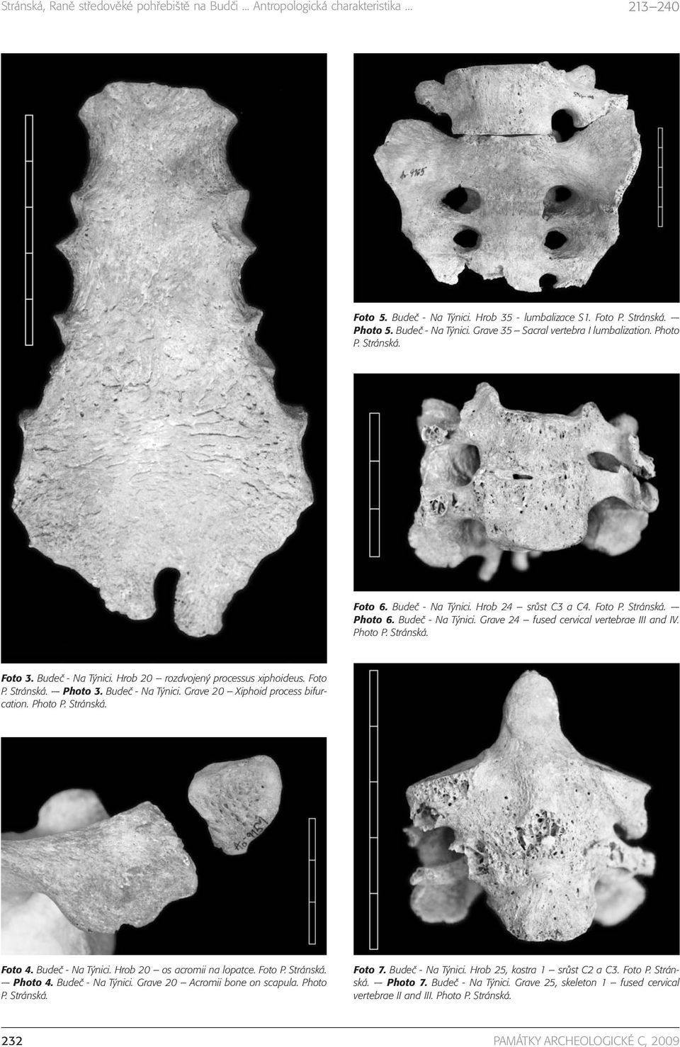 Budeč - Na Týnici. Grave 20 Xiphoid process bifurcation. Photo P. Stránská. Foto 4. Budeč - Na Týnici. Hrob 20 os acromii na lopatce. Foto P. Stránská. Photo 4. Budeč - Na Týnici. Grave 20 Acromii bone on scapula.