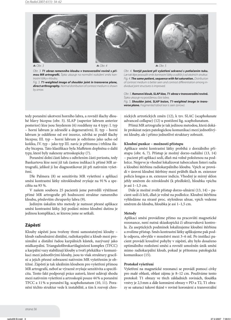 Lze tak lépe posoudit směs kontrastní látky a odlišit ji od okolních struktur. Fig. 4. The same patient, sequence with fat saturation.