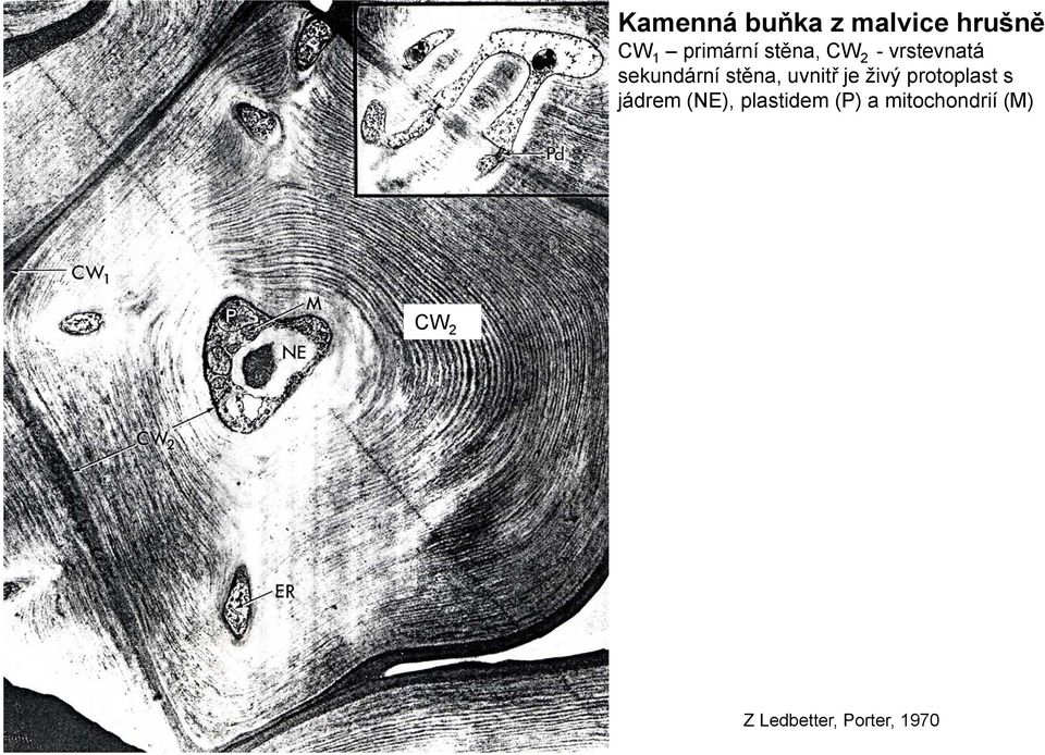 uvnitř je živý protoplast s jádrem (NE),