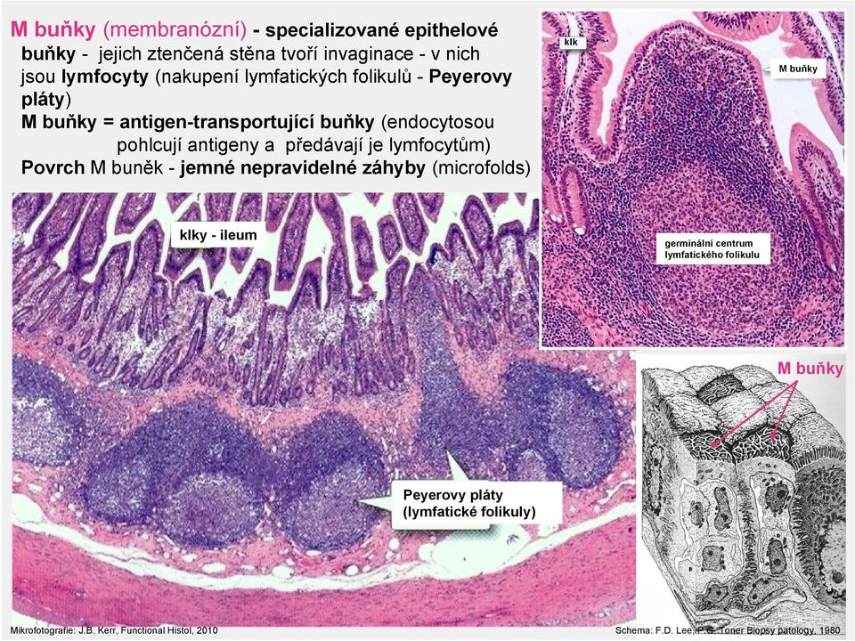 lymfocytům) Povrch M buněk - jemné nepravidelné záhyby (microfolds) klky - ileum klk M buňky germinální centrum lymfatického folikulu