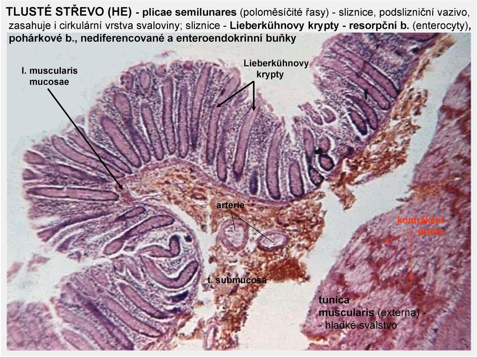 (enterocyty), pohárkové b., nediferencované a enteroendokrinní buňky l.