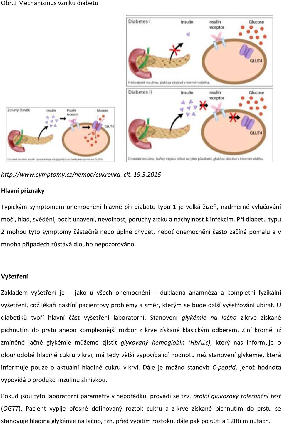 Při diabetu typu 2 mohou tyto symptomy částečně nebo úplně chybět, neboť onemocnění často začíná pomalu a v mnoha případech zůstává dlouho nepozorováno.