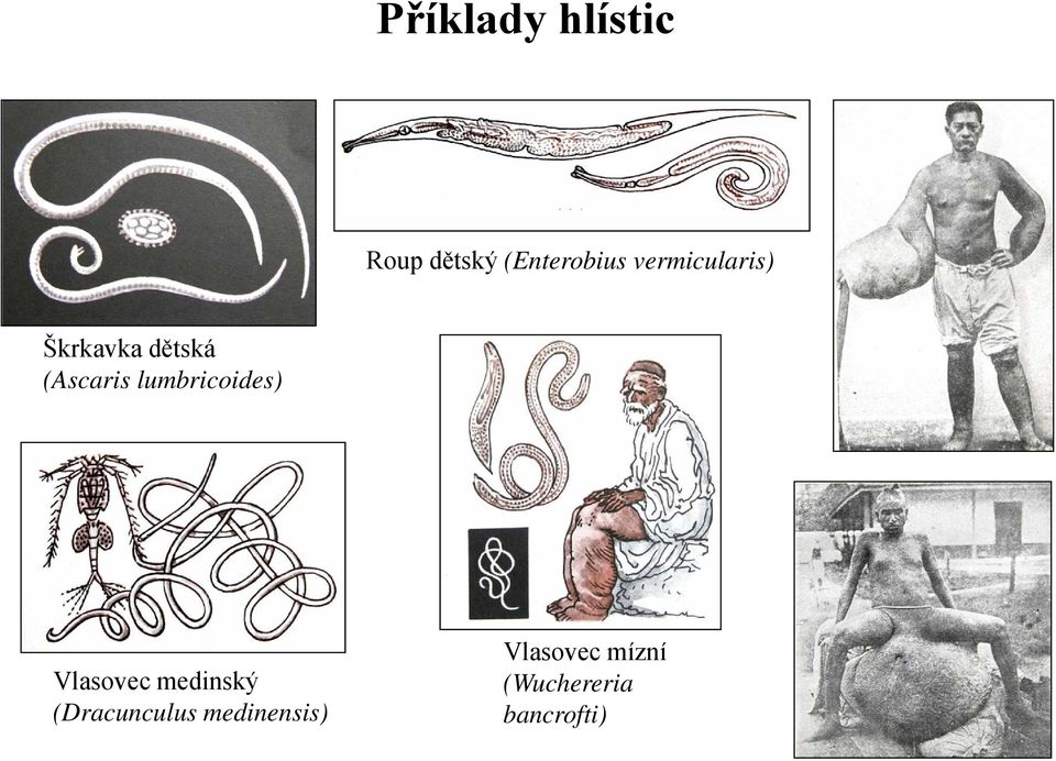 lumbricoides) Vlasovec medinský