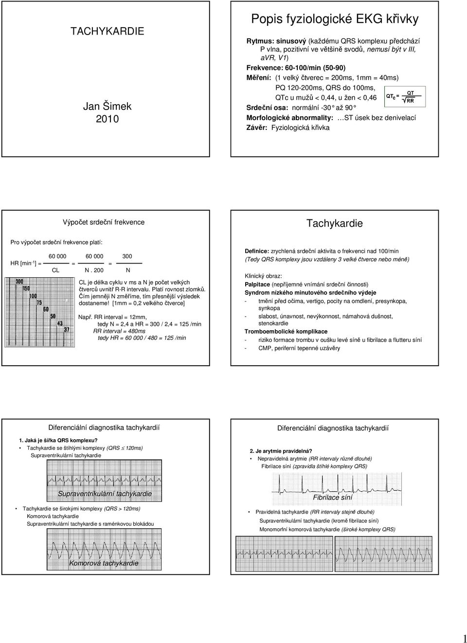 křivka Pro výpočet srdeční frekvence platí: Výpočet srdeční frekvence 60 000 60 000 300 HR [min - ] = = = CL N. 00 N CL je délka cyklu v ms a N je počet velkých čtverců uvnitř R-R intervalu.