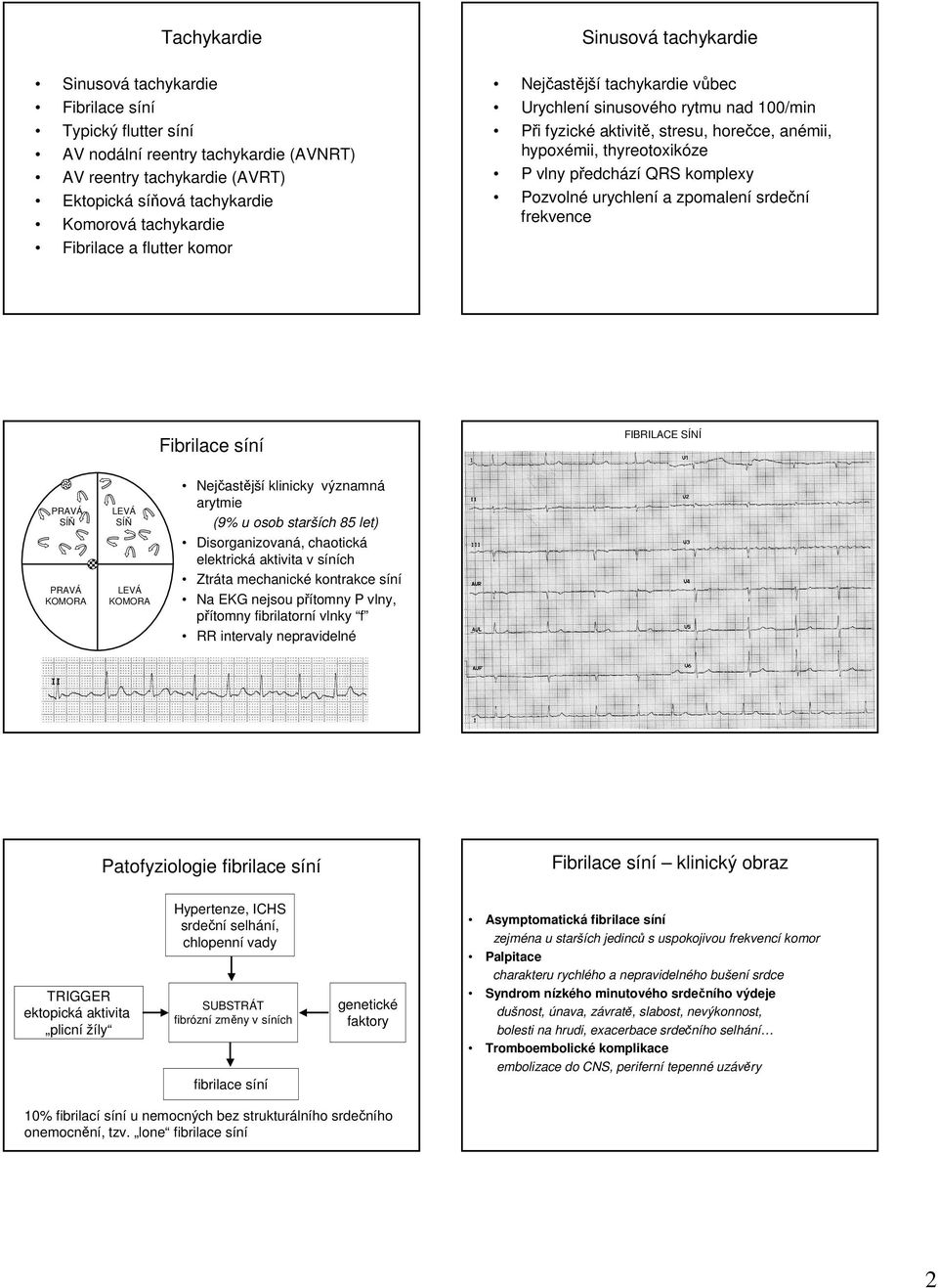 vlny, přítomny fibrilatorní vlnky f RR intervaly nepravidelné klinický obraz Patofyziologie fibrilace síní Hypertenze, ICHS srdeční selhání, chlopenní vady TRIGGER ektopická aktivita plicní žíly