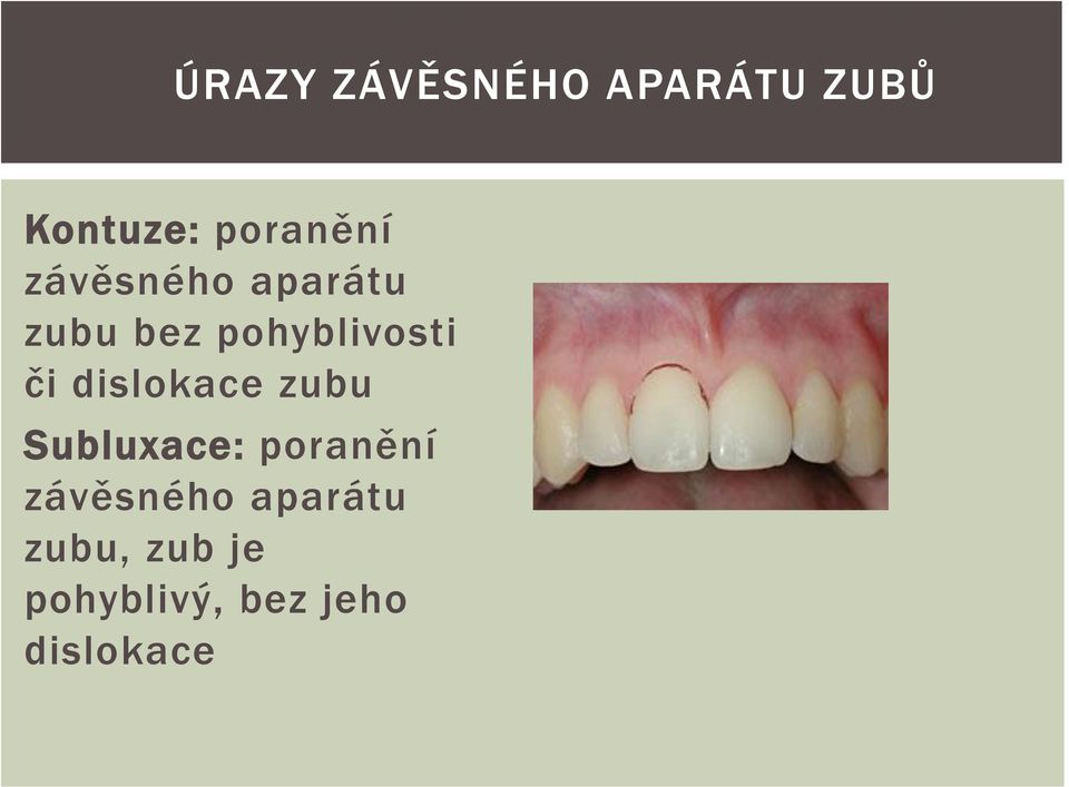 dislokace zubu Subluxace: poranění závěsného