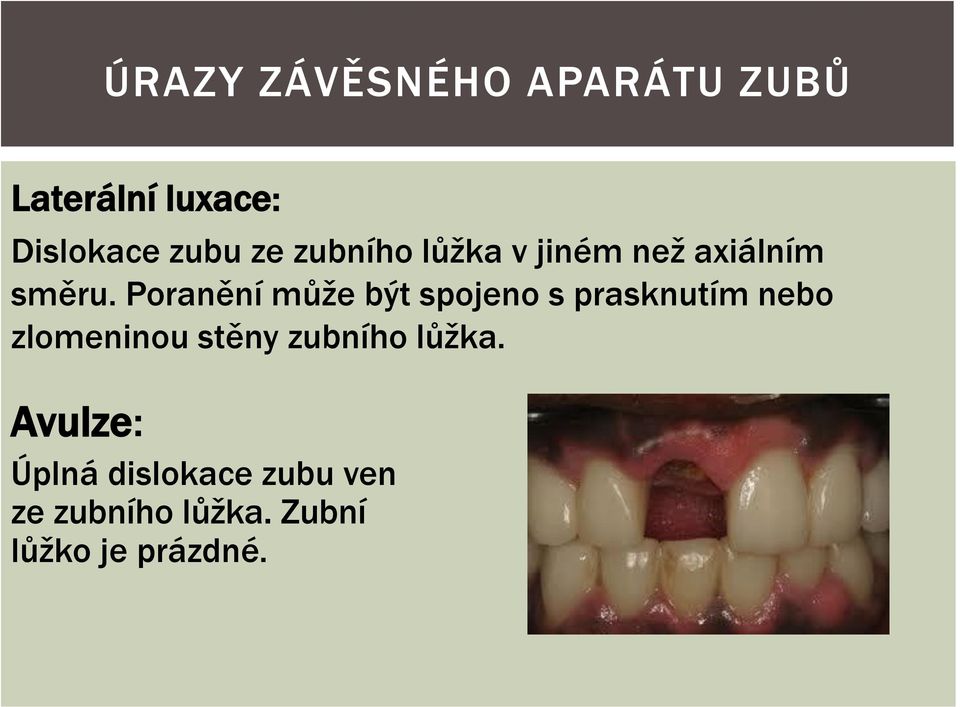 Poranění může být spojeno s prasknutím nebo zlomeninou stěny