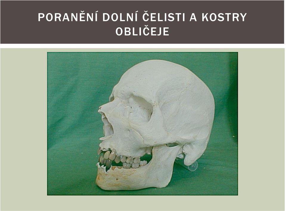 ČELISTI A