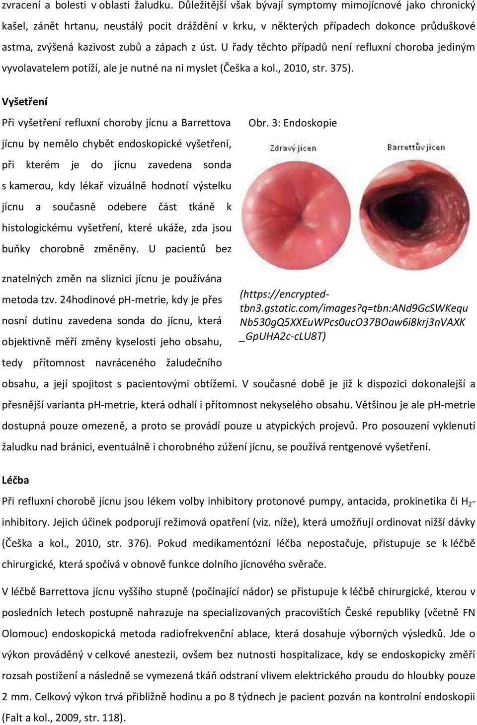 U řady těchto případů není refluxní choroba jediným vyvolavatelem potíží, ale je nutné na ni myslet (Češka a kol., 2010, str. 375).