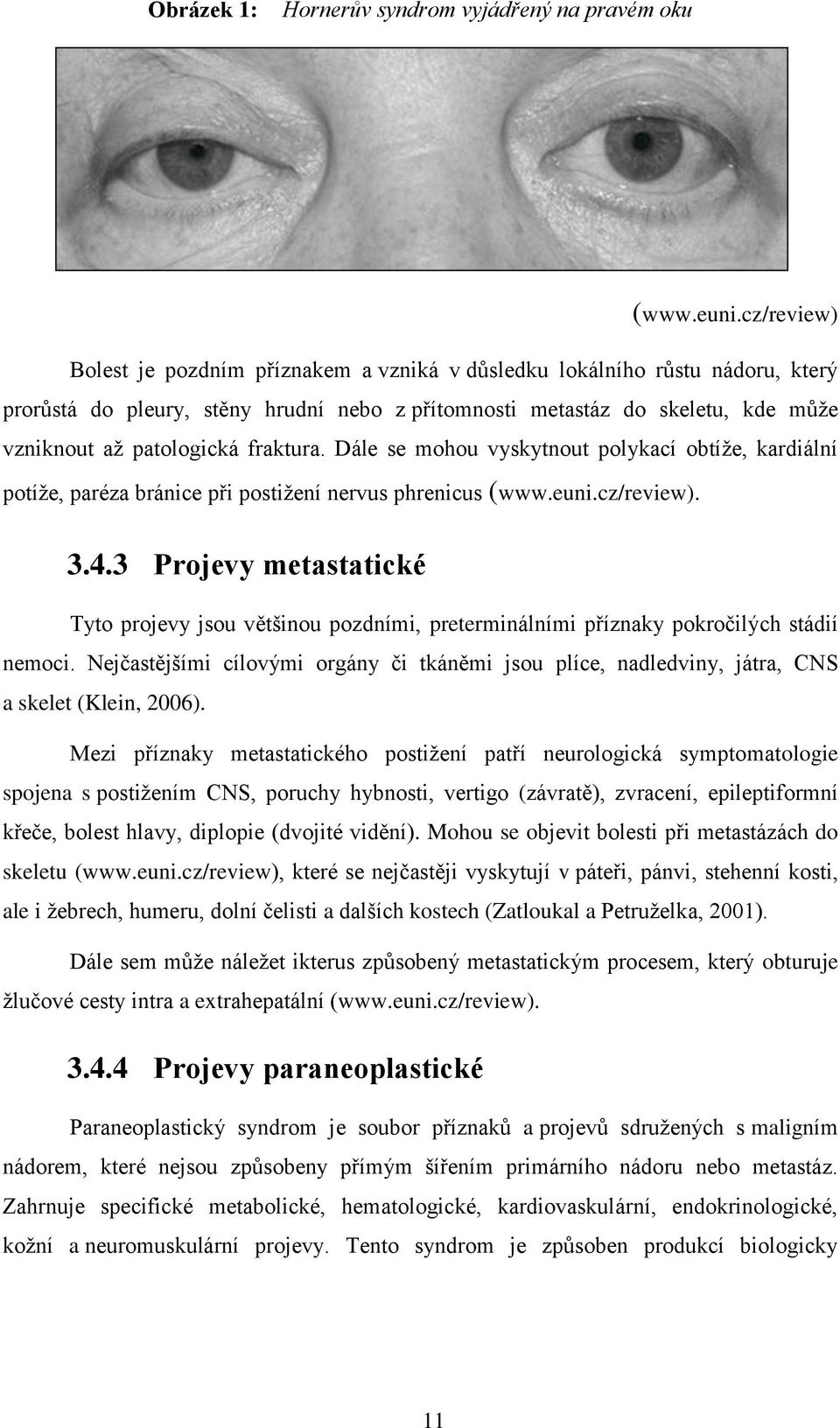 fraktura. Dále se mohou vyskytnout polykací obtíţe, kardiální potíţe, paréza bránice při postiţení nervus phrenicus (www.euni.cz/review). 3.4.