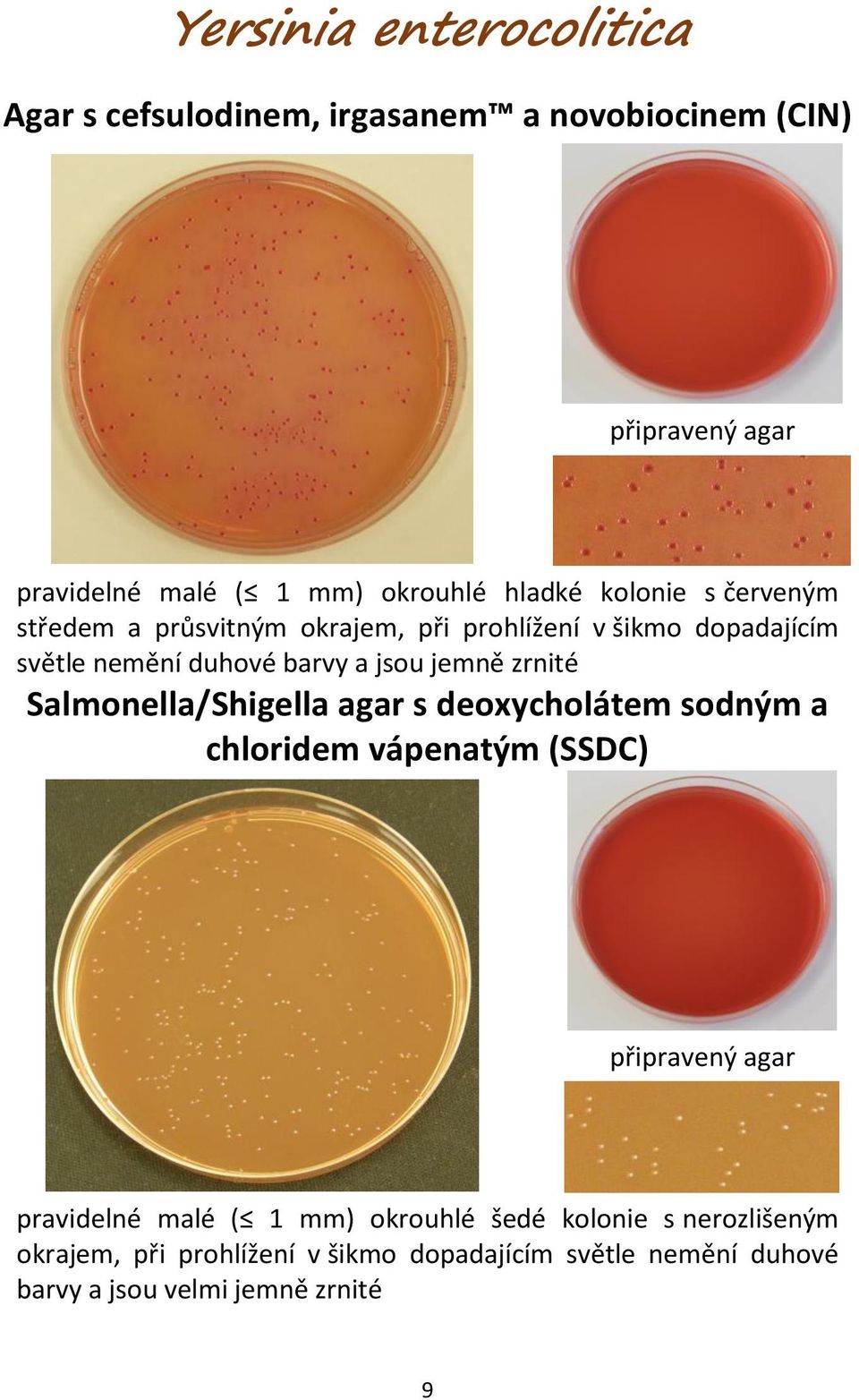 jemně zrnité Salmonella/Shigella agar s deoxycholátem sodným a chloridem vápenatým (SSDC) pravidelné malé ( 1 mm)