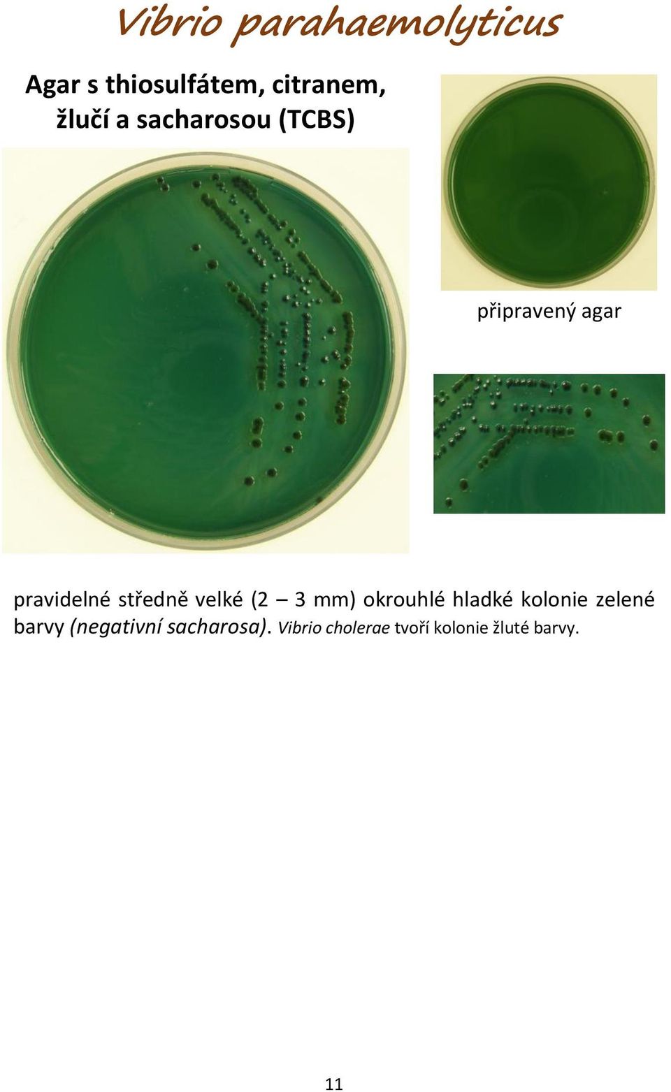 3 mm) okrouhlé hladké kolonie zelené barvy (negativní