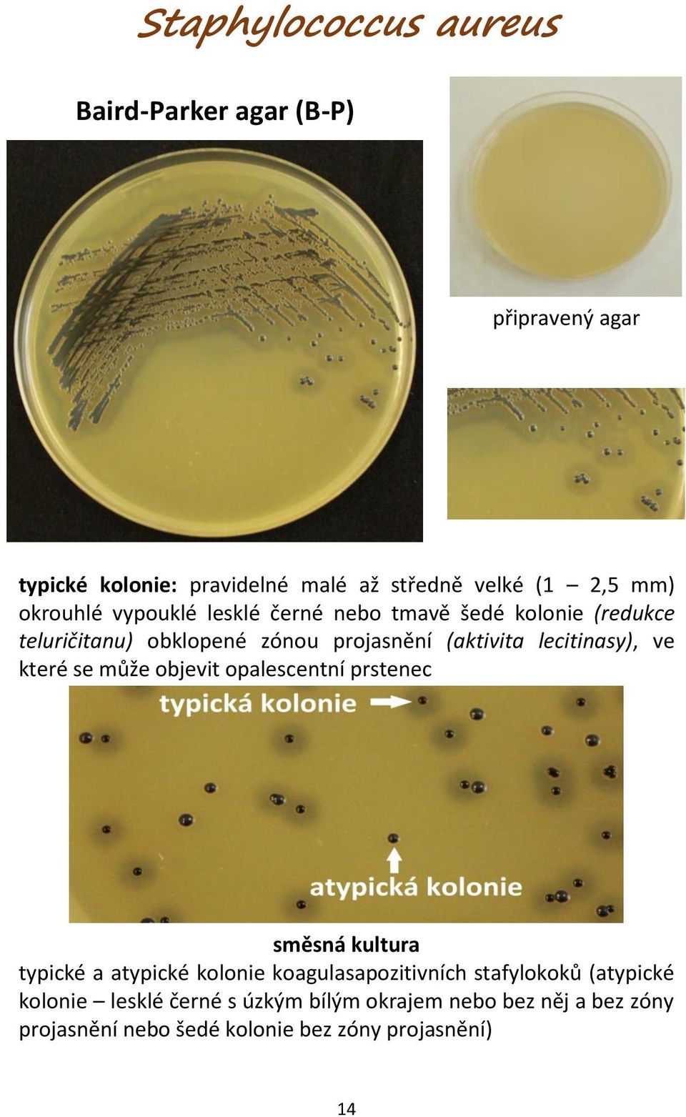 které se může objevit opalescentní prstenec směsná kultura typické a atypické kolonie koagulasapozitivních stafylokoků