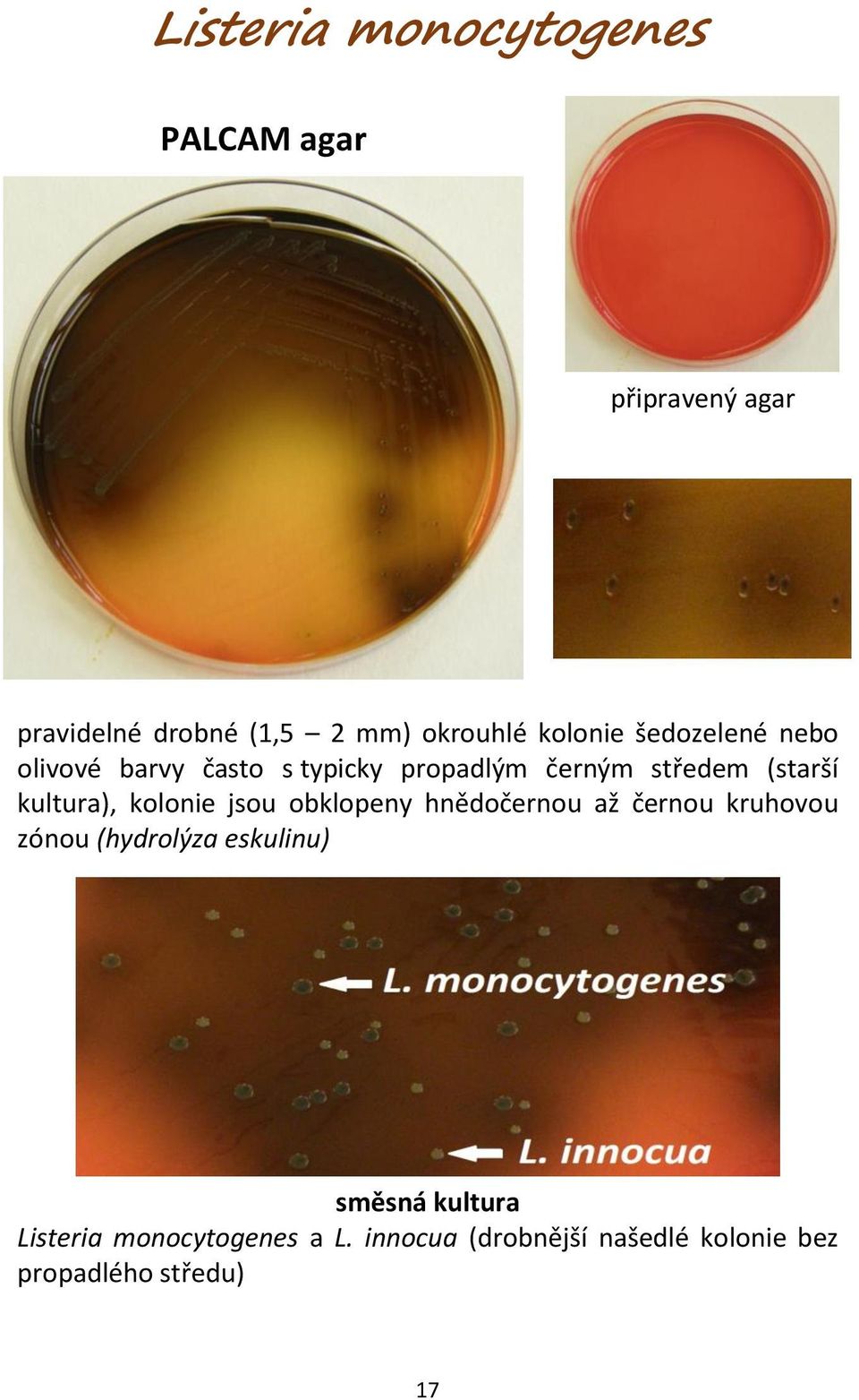 kolonie jsou obklopeny hnědočernou až černou kruhovou zónou (hydrolýza eskulinu) směsná