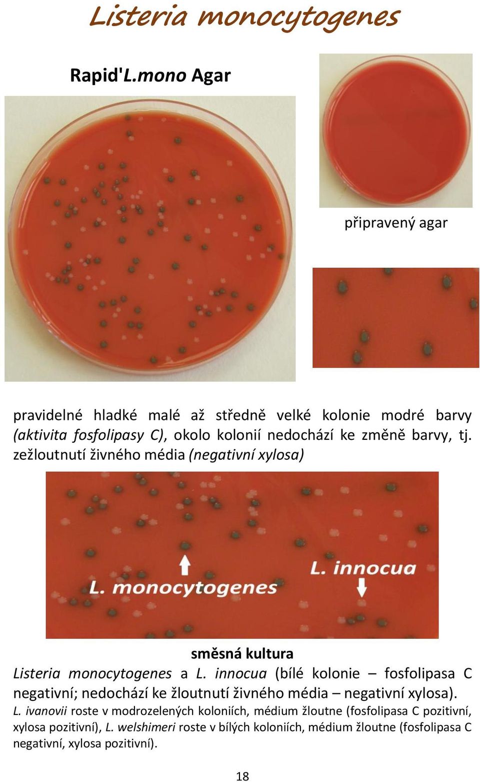 zežloutnutí živného média (negativní xylosa) směsná kultura Listeria monocytogenes a L.