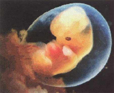 Názvy období vývoje: Zárodek (embryo) od 7 dne do 8 týdnů