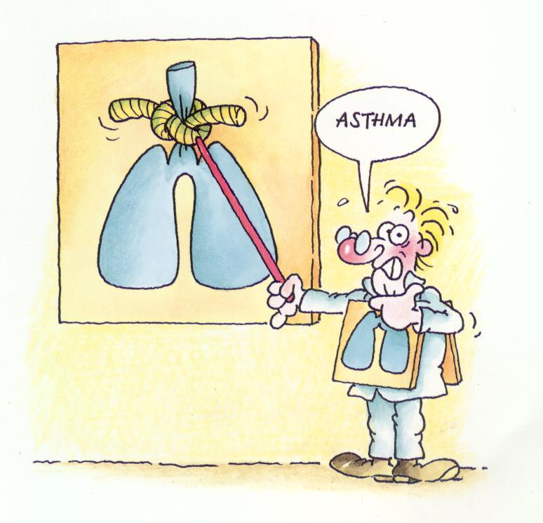 Léčba astmatu Rozpor mezi možnostmi a realitou Astma je dnes velmi