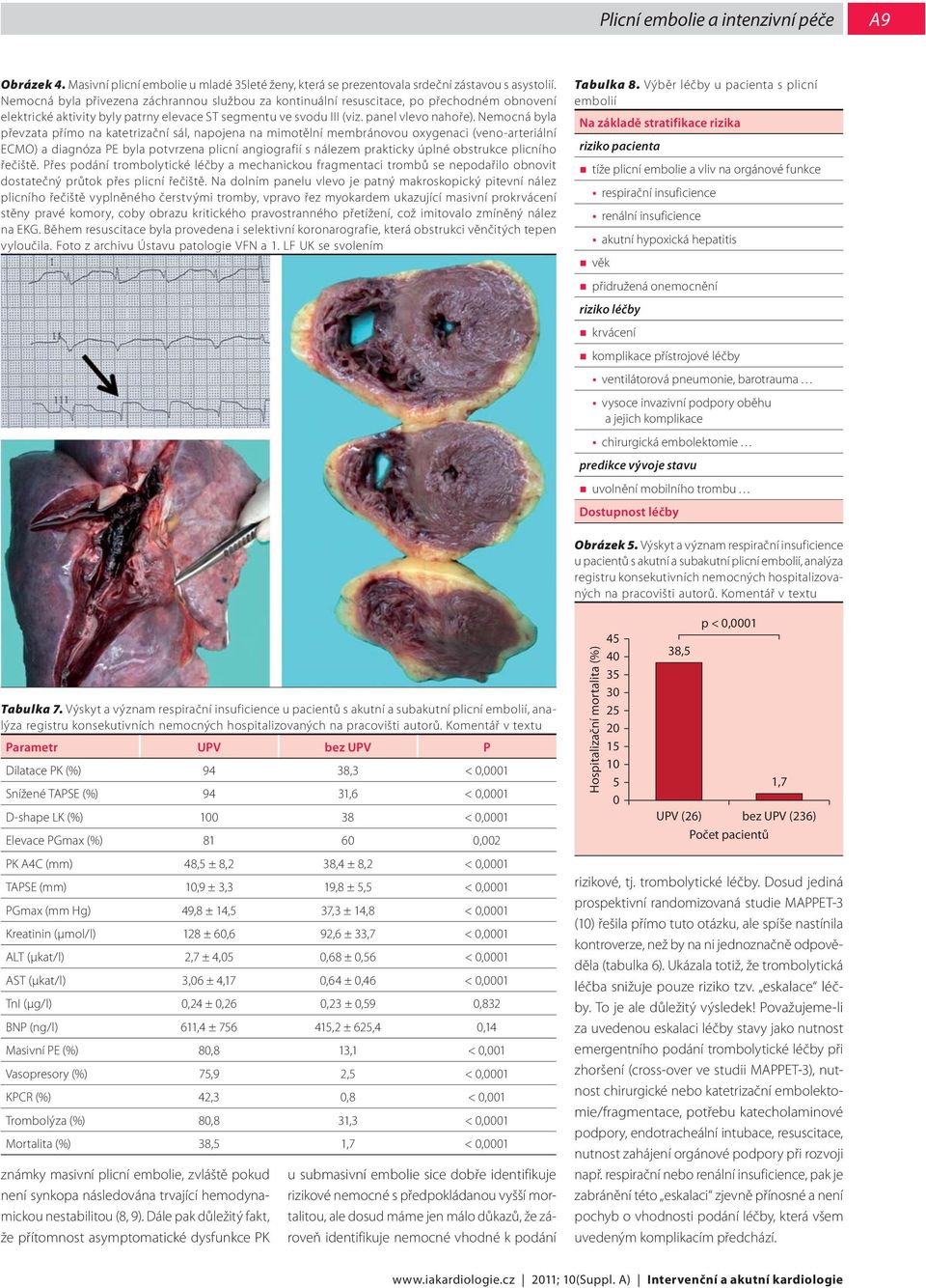 Nemocná byla převzata přímo na katetrizační sál, napojena na mimotělní membránovou oxygenaci (veno-arteriální ECMO) a diagnóza PE byla potvrzena plicní angiografií s nálezem prakticky úplné obstrukce