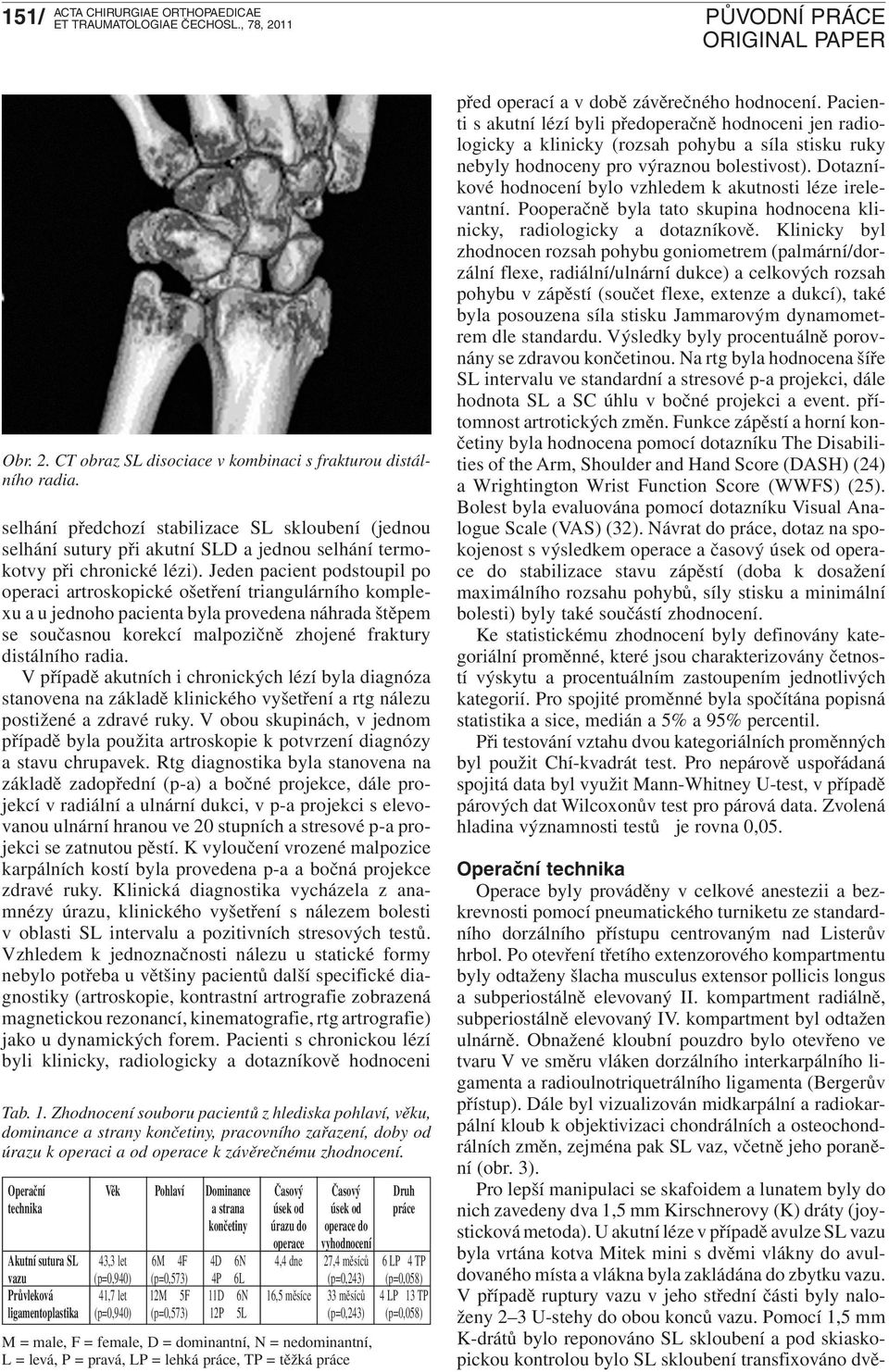 Po otevření třetího extenzorového kompartmentu byly odtaženy šlacha musculus extensor pollicis longus a subperiostálně elevovaný II. kompartment radiálně, subperiostálně elevovaný IV.