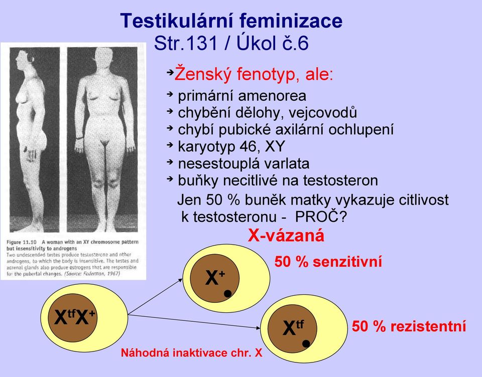 pubické axilární ochlupení karyotyp 46, XY nesestouplá varlata buňky necitlivé na