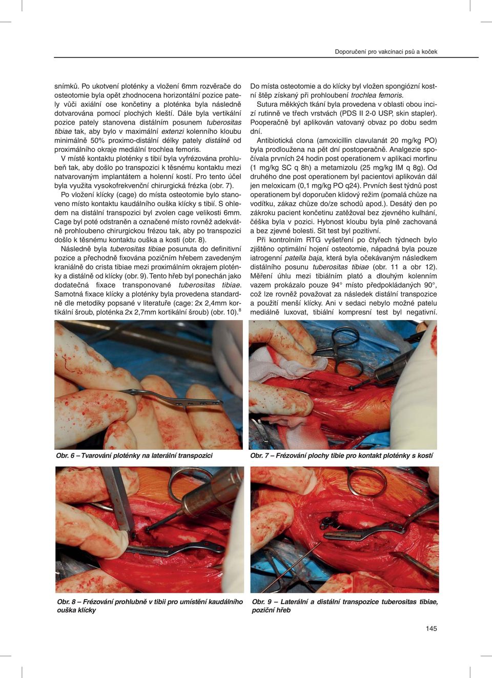 Dále byla vertikální pozice pately stanovena distálním posunem tuberositas tibiae tak, aby bylo v maximální extenzi kolenního kloubu minimálně 50% proximo-distální délky pately distálně od