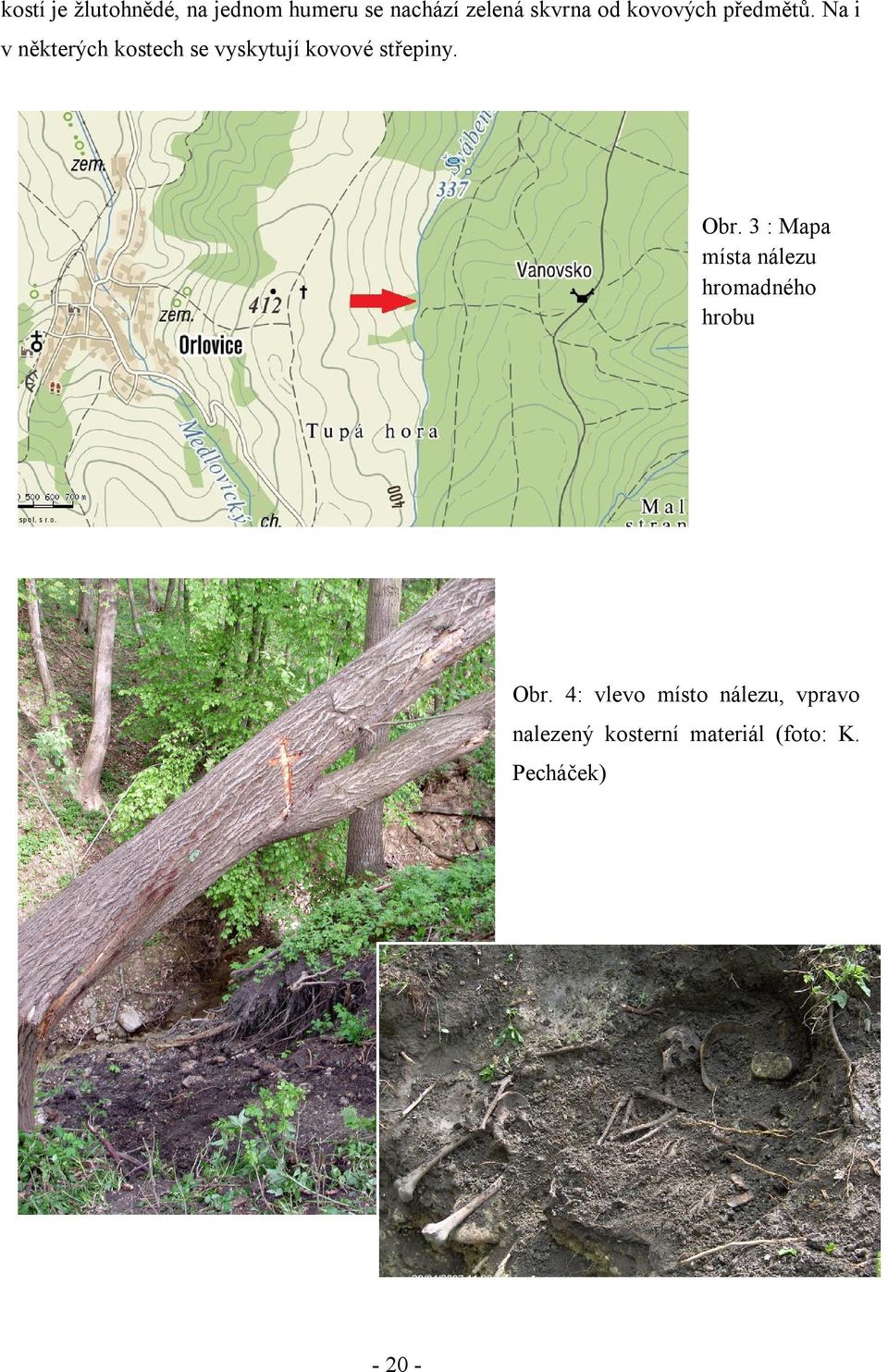 Na i v některých kostech se vyskytují kovové střepiny. Obr.