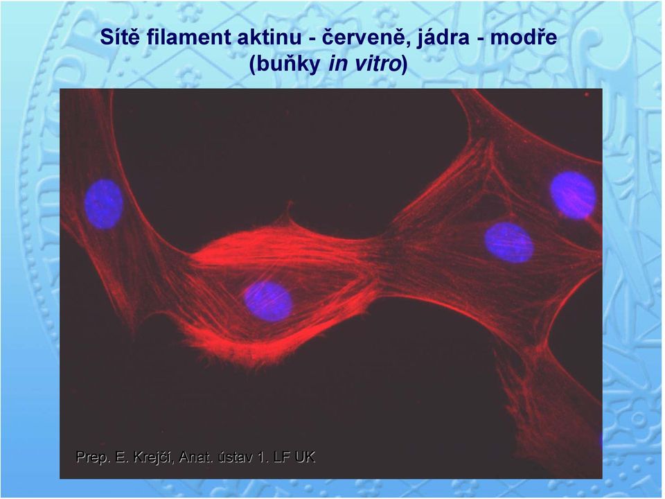 (buňky in vitro) Prep.. E.