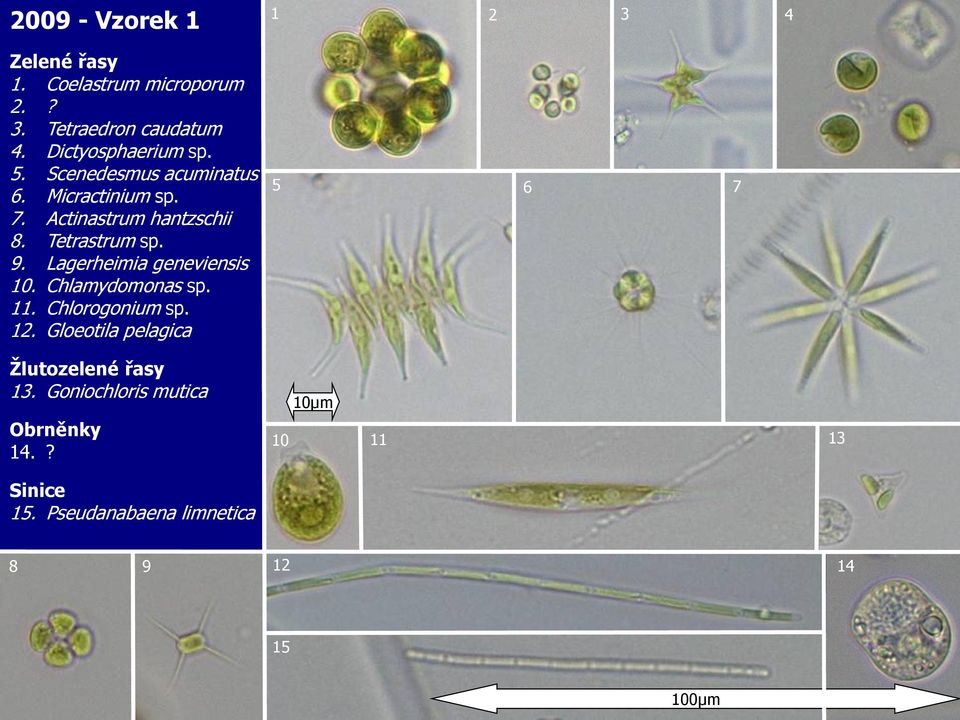 Tetrastrum sp. 9. Lagerheimia geneviensis 10. Chlamydomonas sp. 11. Chlorogonium sp. 12.