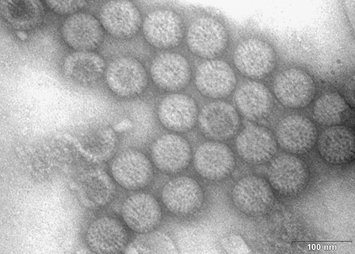 Původci virových infekcí: Rotaviry (A, C) Koronaviry (PED) Virové enterální infekce Caliciviry (Noroviry, Kobuviry), Astroviry Používané metody