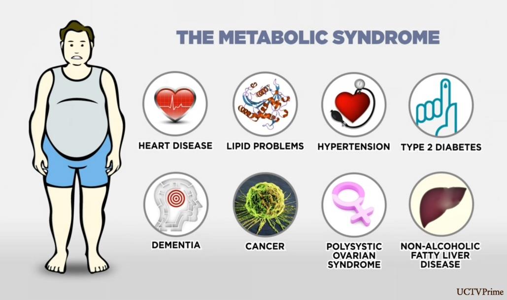 Metabolický syndrom Společný výskyt příznaků - vedou k závažným kardiovaskulárním chorobám (ateroskleróza, cévně mozkové příhody, ischemická choroba srdeční, infarkty, ) a dalším problémům (horm.