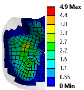 Lokace chrupavky 1 2 Max.hod. [MPa] Kontaktní tlak chrupavka na i 1 [x10 5 Pa] chrupavka na i 2 [x10 5 Pa] D 3 MC hlavatá 2.8/13.0 E 4 MC hákovitá 5.0/4.9 F 5 MC hákovitá 3.3/4.