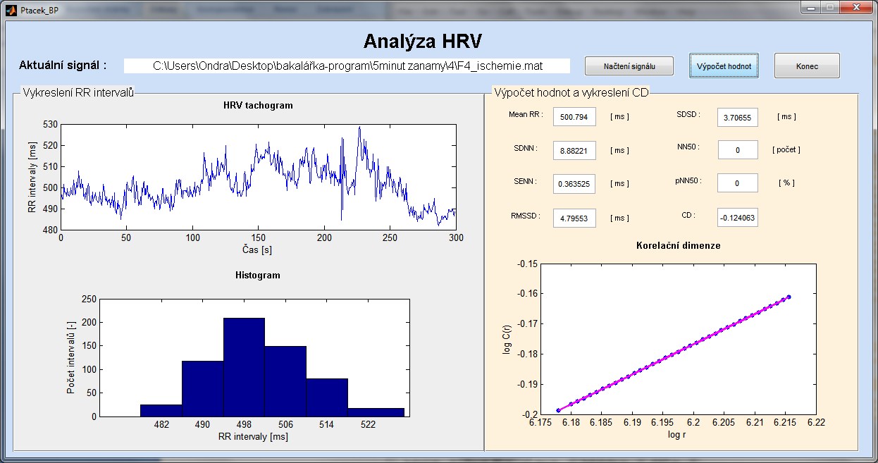 4. Uživatelské rozhraní V programovém prostředí Matlab bylo za úkol vytvořit grafické rozhraní, které bude vhodné pro analýzu HRV.
