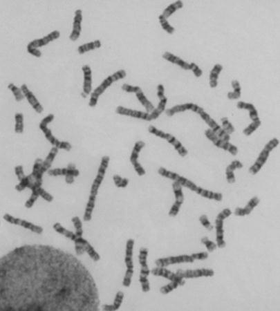 barvení / pruhování chromosomů barvení Giemsovým barvivem (bez inkubace v roztoku trypsinu, obarvuje chromosomy po celé délce) - hodnocení získaných chr.