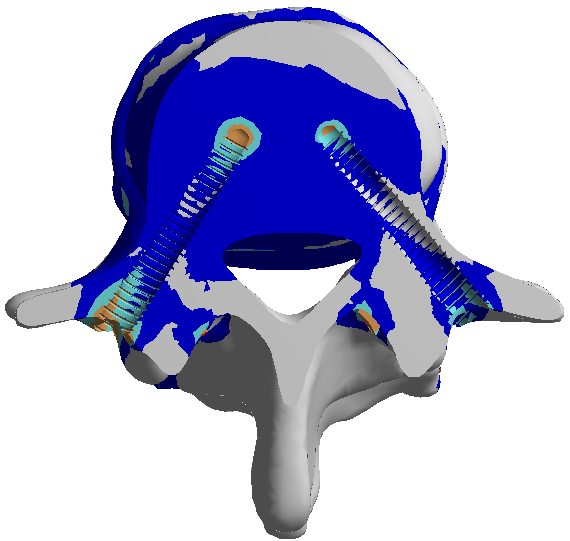 Maximální kontaktní tlak [MPa] Ústav mechaniky, mechatroniky a biomechaniky těles 2,5 2 1,5 1 0,5 0 L2/L3L L2/L3R L3/L4L L3/L4R L4/L5L L4/L5R fyziologický s degradovanou ploténkou s degradovanou