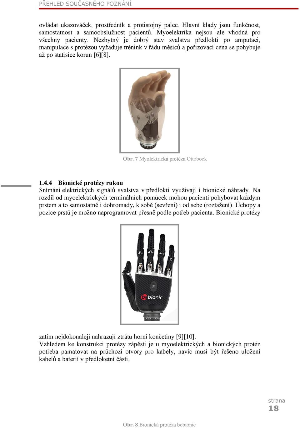 Nezbytný je dobrý stav svalstva předloktí po amputaci, manipulace s protézou vyžaduje trénink v řádu měsíců a pořizovací cena se pohybuje až po statisíce korun [6][8]. Obr.