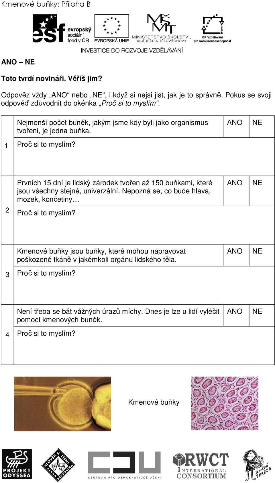 2 Prvních 15 dní je lidský zárodek tvořen až 150 buňkami, které jsou všechny stejné, univerzální. Nepozná se, co bude hlava, mozek, končetiny Proč si to myslím?