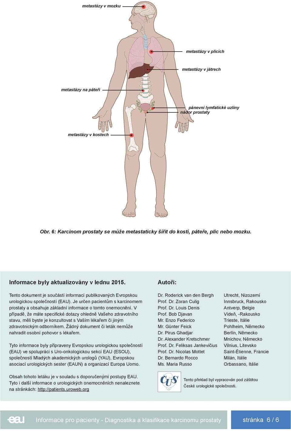 Tento dokument je součástí informací publikovaných Evropskou urologickou společností (EAU). Je určen pacientům s karcinomem prostaty a obsahuje základní informace o tomto onemocnění.