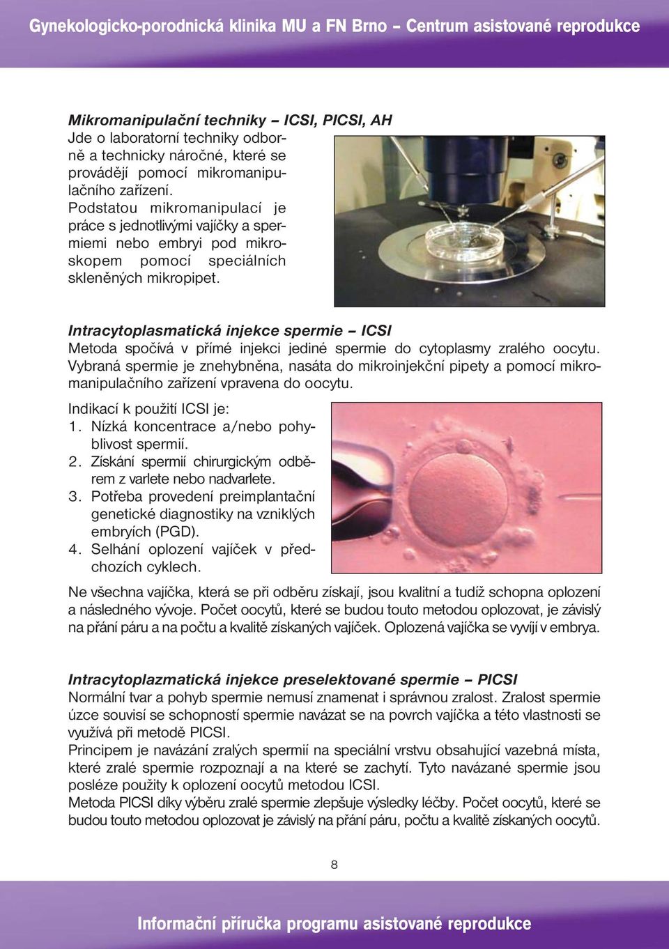 Intracytoplasmatická injekce spermie ICSI Metoda spočívá v přímé injekci jediné spermie do cytoplasmy zralého oocytu.