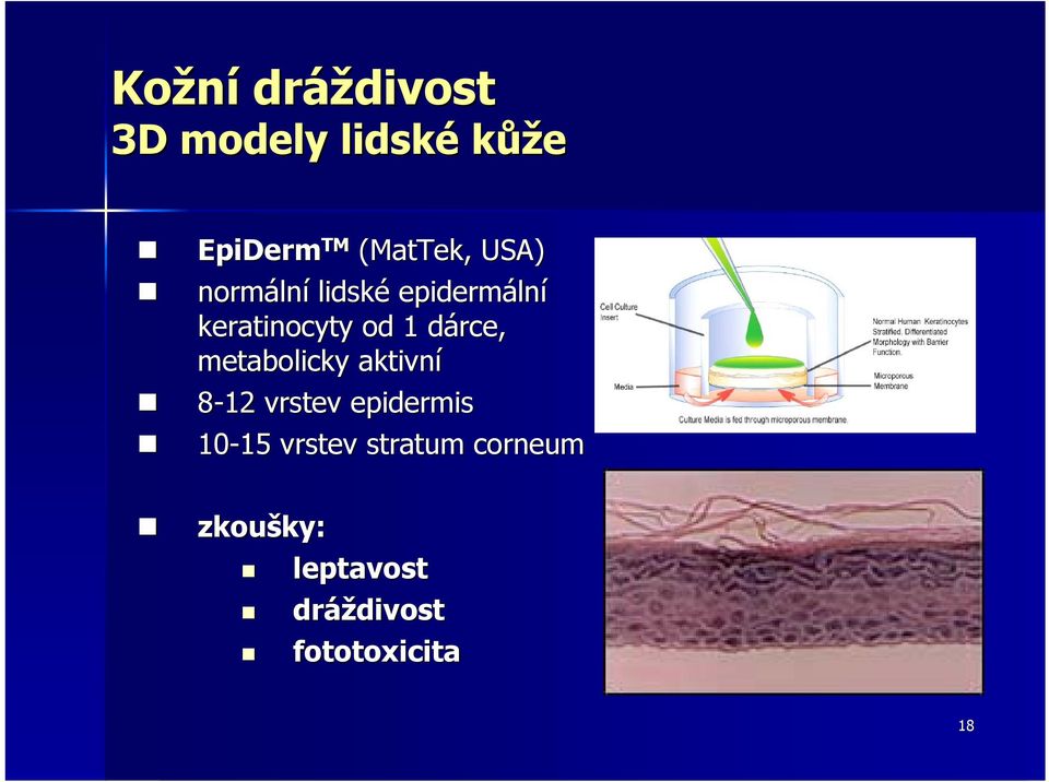 metabolicky aktivní 8-12 vrstev epidermis 10-15 15 vrstev