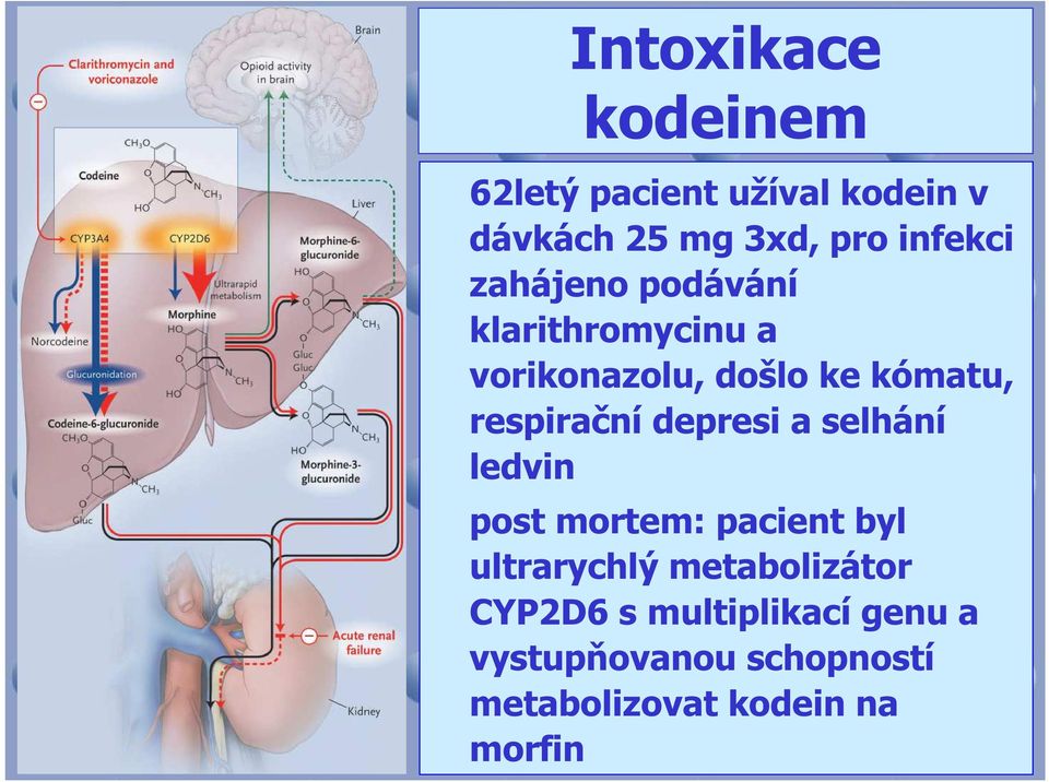 respirační depresi a selhání ledvin post mortem: pacient byl ultrarychlý