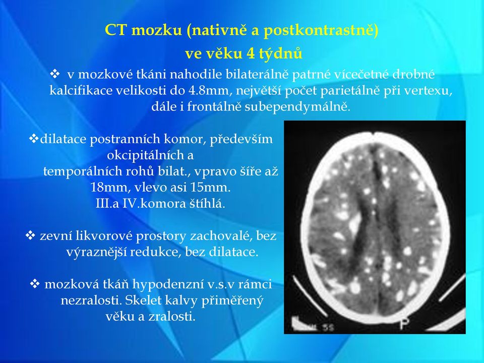 dilatace postranních komor, především okcipitálních a temporálních rohů bilat., vpravo šíře až 18mm, vlevo asi 15mm. III.a IV.