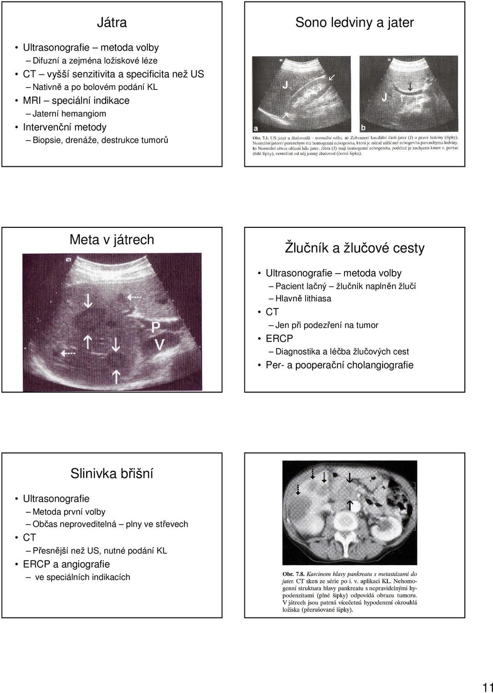 Pacient lačný žlučník naplněn žlučí Hlavně lithiasa CT Jen při podezření na tumor ERCP Diagnostika a léčba žlučových cest Per- a pooperační cholangiografie