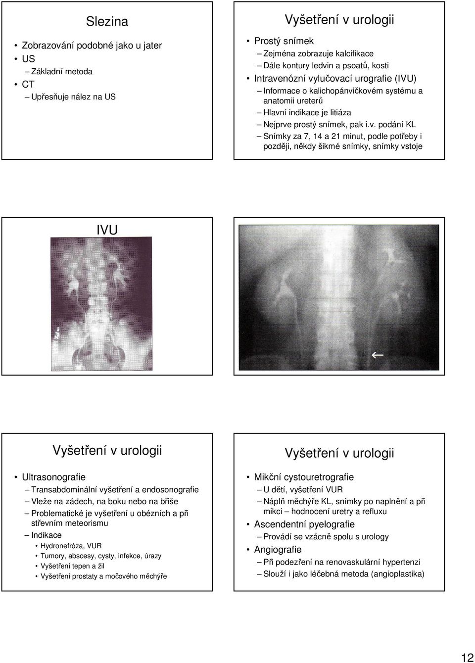 později, někdy šikmé snímky, snímky vstoje IVU Vyšetření v urologii Ultrasonografie Transabdominální vyšetření a endosonografie Vleže na zádech, na boku nebo na břiše Problematické je vyšetření u