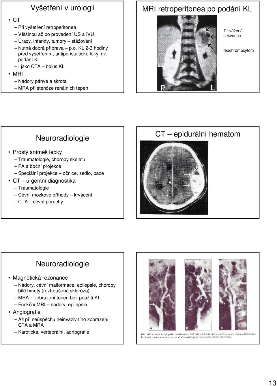 Prostý snímek lebky Traumatologie, choroby skeletu PA a boční projekce Speciální projekce očnice, sedlo, baze CT urgentní diagnostika Traumatologie Cévní mozkové příhody krvácení CTA cévní poruchy