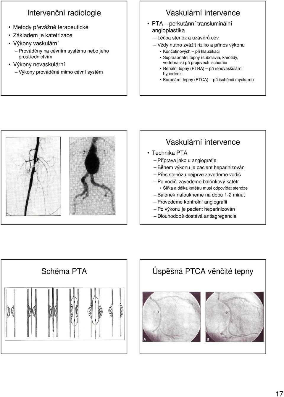 (subclavia, karotidy, vertebralis) při projevech ischemie Renální tepny (PTRA) při renovaskulární hypertenzi Koronární tepny (PTCA) při ischémii myokardu Vaskulární intervence Technika PTA Příprava