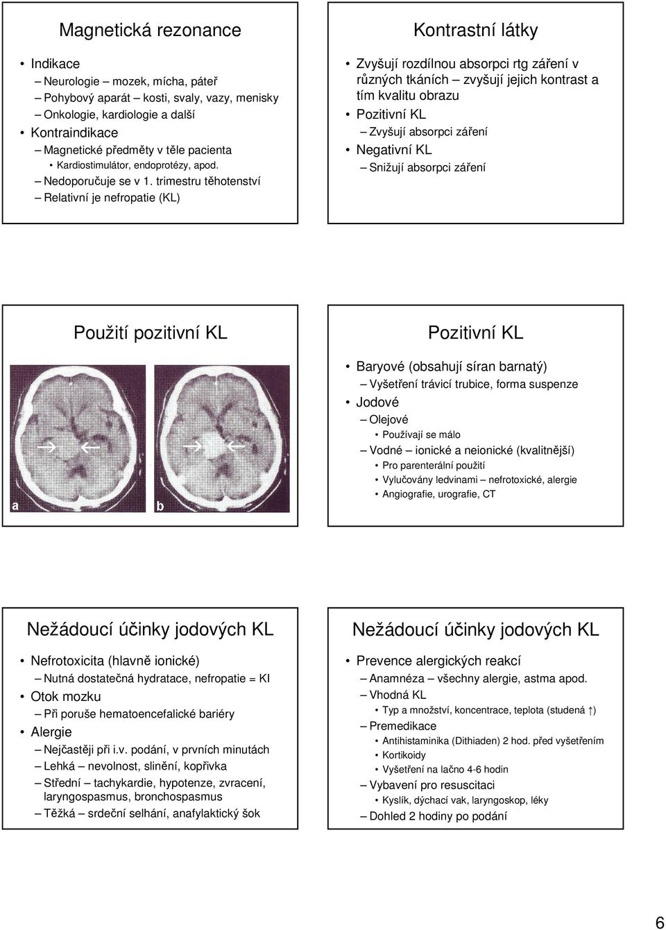 trimestru těhotenství Relativní je nefropatie (KL) Kontrastní látky Zvyšují rozdílnou absorpci rtg záření v různých tkáních zvyšují jejich kontrast a tím kvalitu obrazu Pozitivní KL Zvyšují absorpci