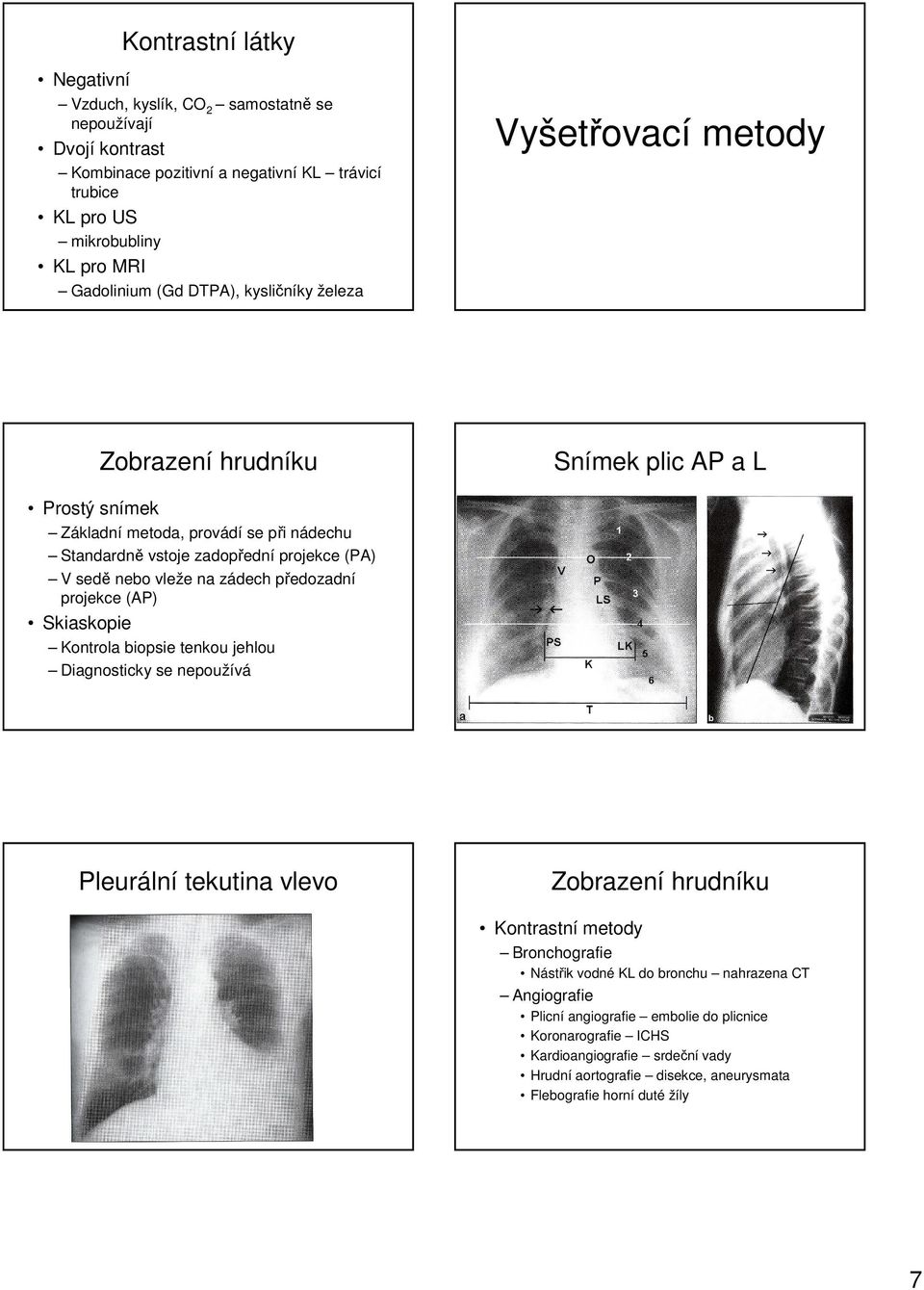 na zádech předozadní projekce (AP) Skiaskopie Kontrola biopsie tenkou jehlou Diagnosticky se nepoužívá Pleurální tekutina vlevo Zobrazení hrudníku Kontrastní metody Bronchografie Nástřik vodné