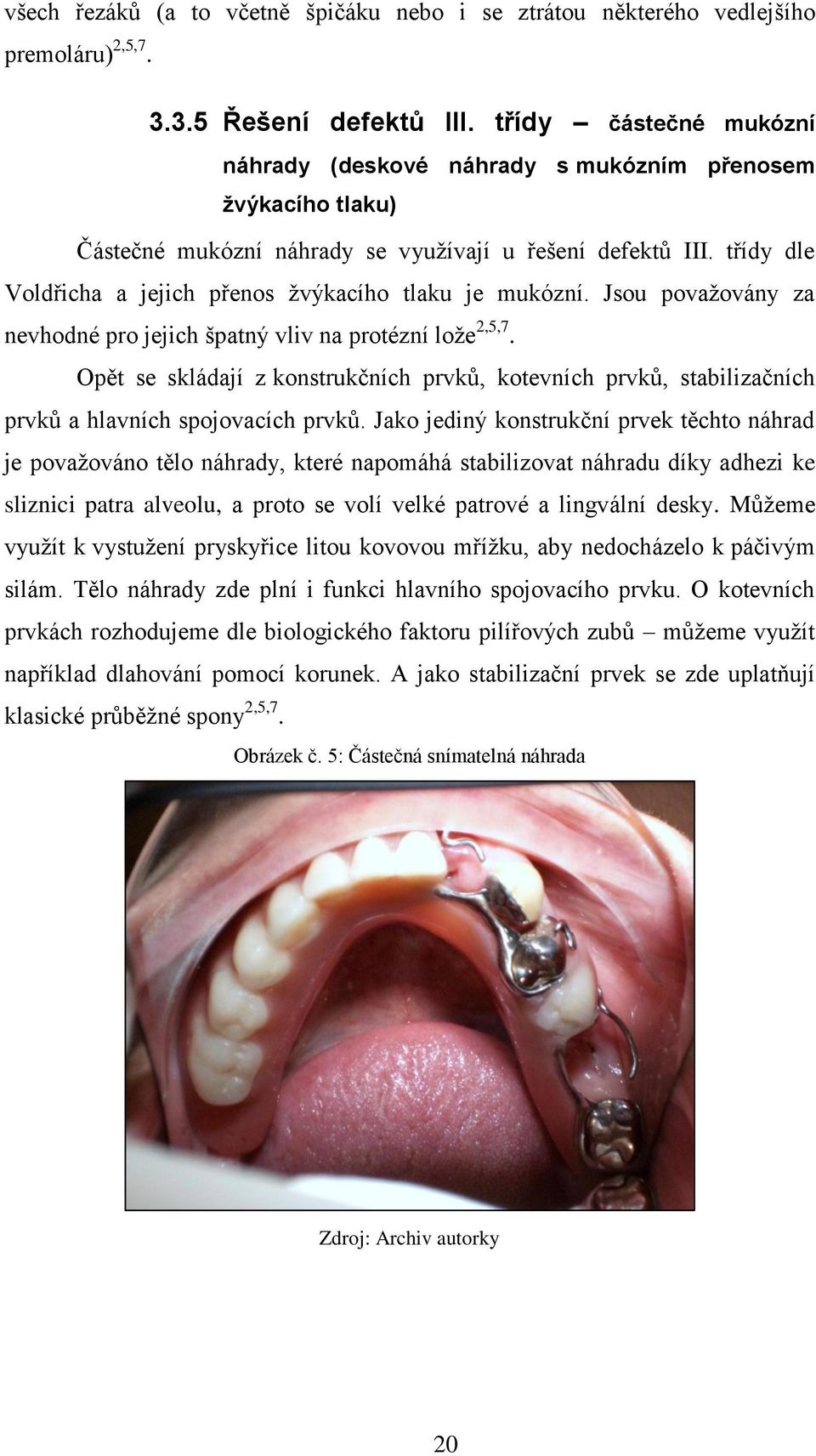 třídy dle Voldřicha a jejich přenos žvýkacího tlaku je mukózní. Jsou považovány za nevhodné pro jejich špatný vliv na protézní lože 2,5,7.