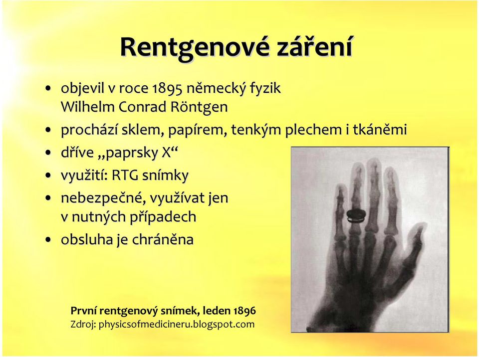 RTG snímky nebezpečné, využívat jen v nutných případech obsluha je chráněna